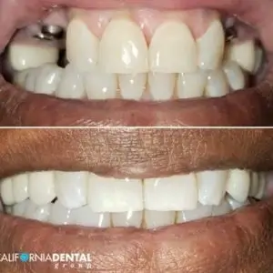 California-Dental-Group-Los-Angeles-cal-dental-group