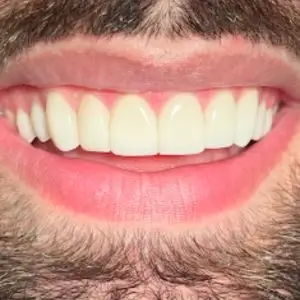 California-Dental-Group-Los-Angeles-dental-insurance-california