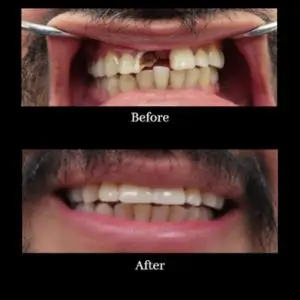 California-Dental-Group-Los-Angeles-dentist-california
