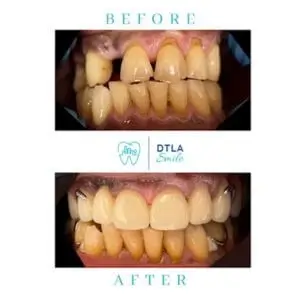 DTLA-smile-dental-smiles