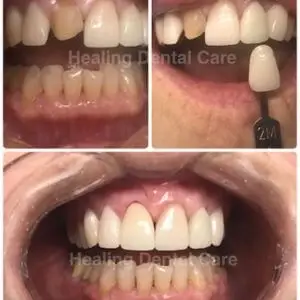 Dentistry-Healing-Dental-Care