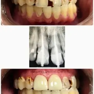 Happy-smile-Healing-Dental-Care