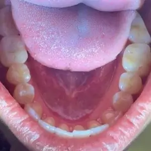 Los-Feliz-Dental-Center-cal-dental-group