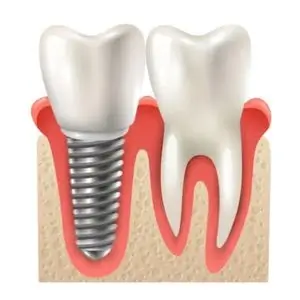 Los-Feliz-Dental-Center-dental-care-los-angeles