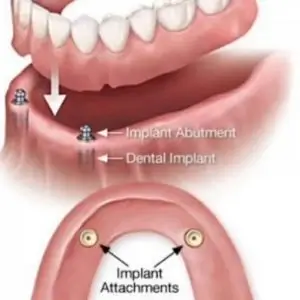 Los-Feliz-Dental-Center-dentists-in-los-angeles