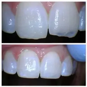 Samaritan-Dental-Arts-california-dental-group