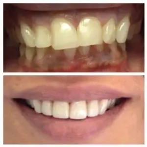 Samaritan-Dental-Arts-happy-smile
