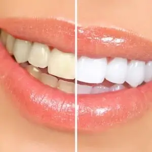 angel-dental-care-Eagle-Rock-Dental-Clinic