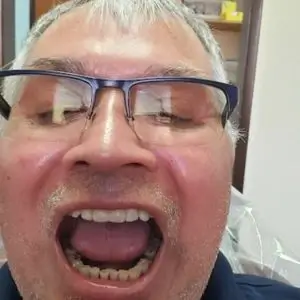 ca-dental-California-Family-Dental-Center-los-angeles