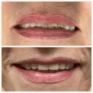 california-dental-Crystal-Dental