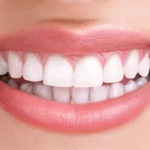 dental-care-california-Impressive-Dental
