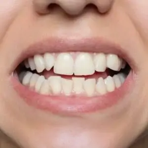 dental-care--los-angeles-Impressive-Dental