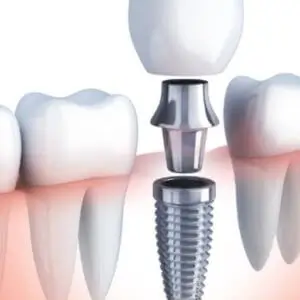 dental-community-clinic-dental