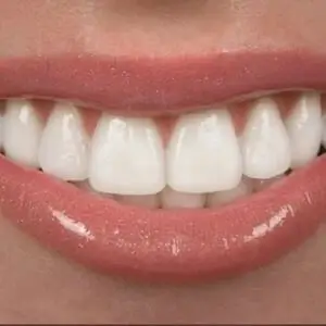 dental-plans-for-washington-state-Los-Angeles