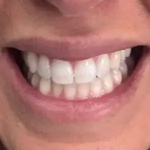 dentist-in-los-angeles-beverly-grove-dentistry