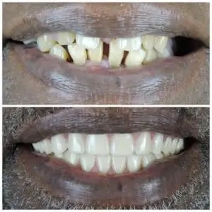 dentist-los-angeles