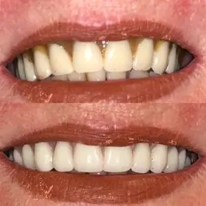dentists-in-los-angeles-beverly-grove-dentistry