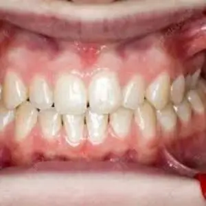 hoover-dental-center-dental-care-dentistry