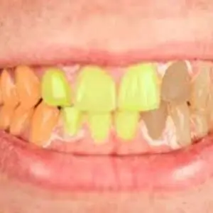 hoover-dental-center-dental-care