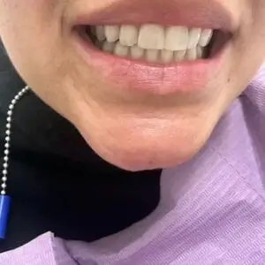 hoover-dental-center-happy-smile-los-angeles