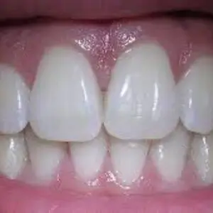 hoover-dental-center-modern-dentistry