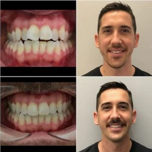 la-dental-clinic-cosmetic-dentistry
