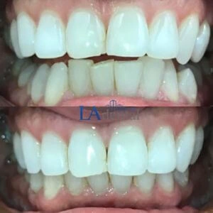 la-dental-clinic-general-dentistry