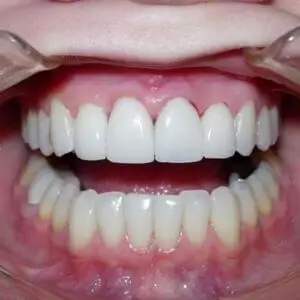 larchmont-dental-associates-best-dentistry