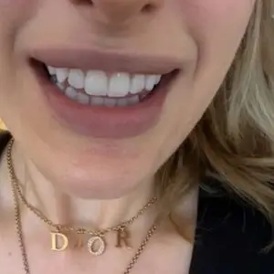 los-angeles-dental-beverly-grove-dentistry