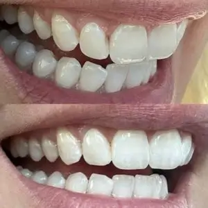 los-angeles-dentist-beverly-grove-dentistry
