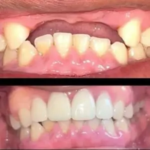 north-vernon-family-dental-los-angeles