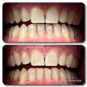 salud-dental-los-angeles
