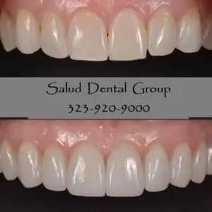 salud-health-dental