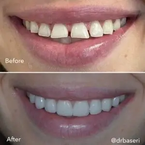 smile-recreation-dentistry-by-dr-baseri-dental-smile-care