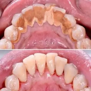 smile-recreation-dentistry-by-dr-baseri-happy-smile-dental-los-angeles