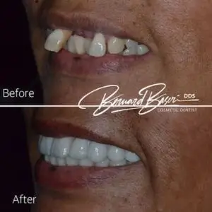 smile-recreation-dentistry-by-dr-baseri-happy-smile-dentist