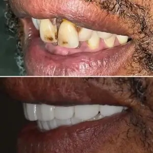 smile-recreation-dentistry-by-dr-baseri-happy-smile-dentistry-los-angeles