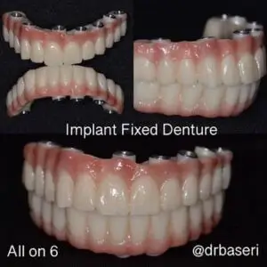 smile-recreation-dentistry-by-dr-baseri-happy-smiles-los-angeles