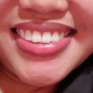 union-dental-center-family-&-emergency-dentistry-union-dentists-los-angeles