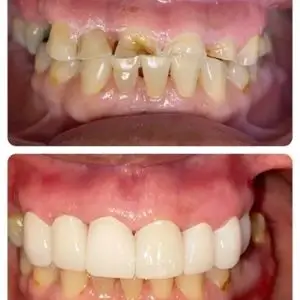vernon-dentists-los-angeles