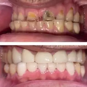 vernon-family-dentist-los-angeles