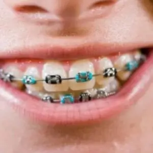 wa-dental-insurance