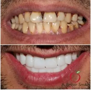 clinic-dental-A-briter-smile-dental-group