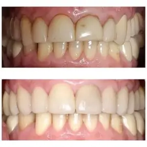 culver-city-dental
