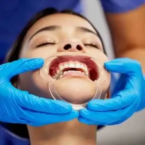 culver-city-dentist