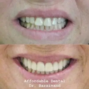 dentist-in-los-angeles affordable-dental