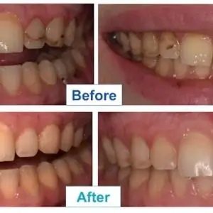 dentist-in-los-angeles-dr-merchant-dds-emergency-dentistry-and-oral-surgery