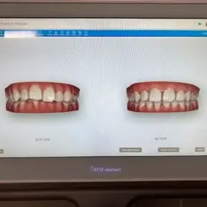 dentist-los-angeles-dr-merchant-dds-emergency-dentistry-and-oral-surgery