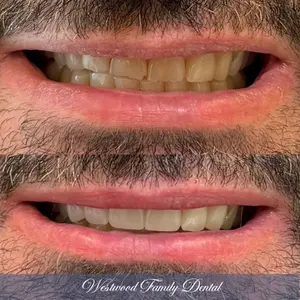 dentist-westwood-in-ca