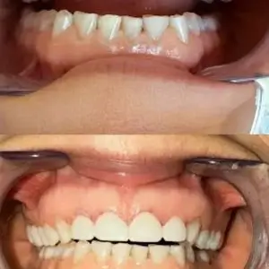 dentists-A-briter-smile-dental-group-los-angeles